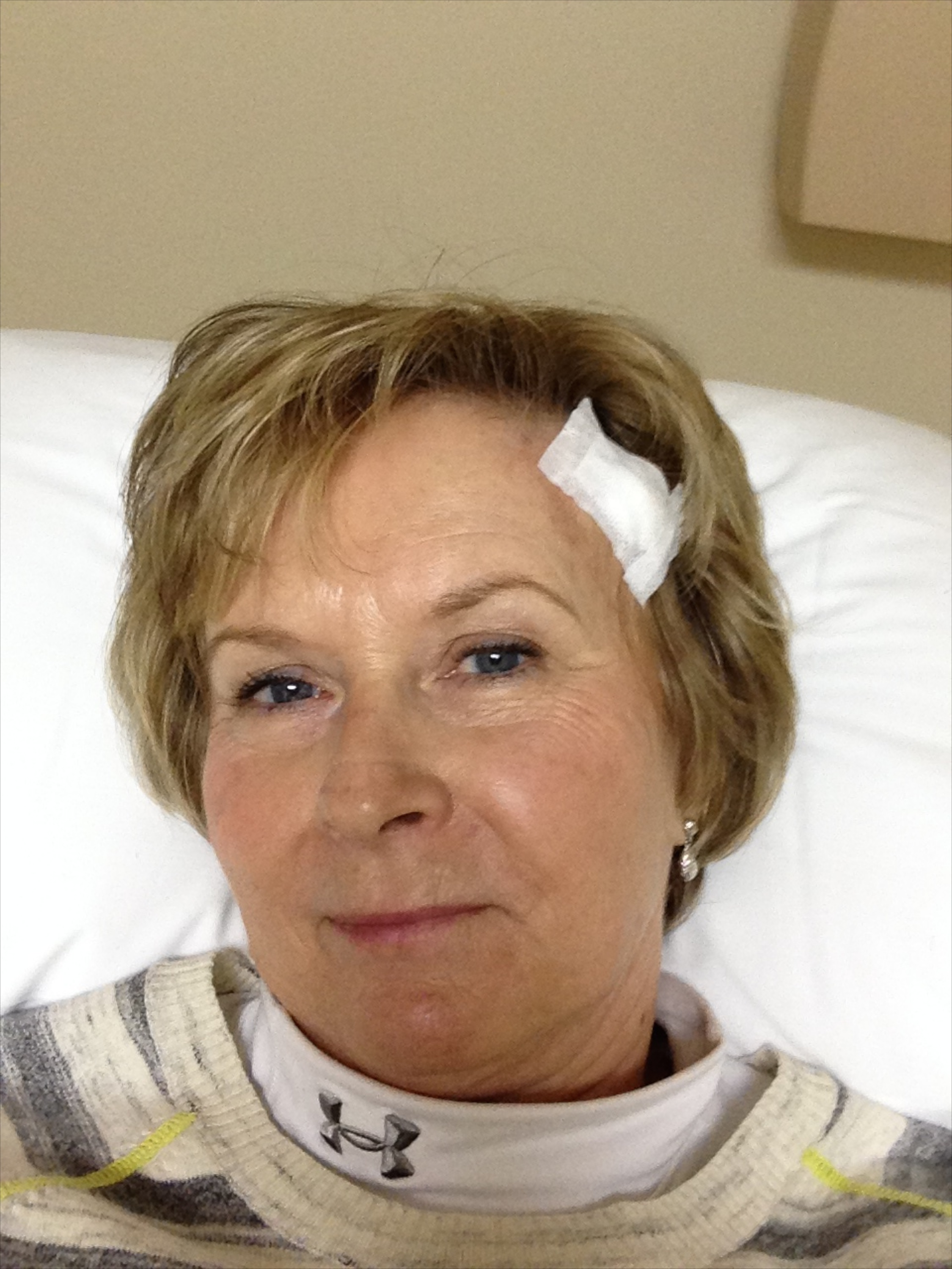 2014-03-05 11-45-59 Basal Cell Carcinoma surgery.jpg